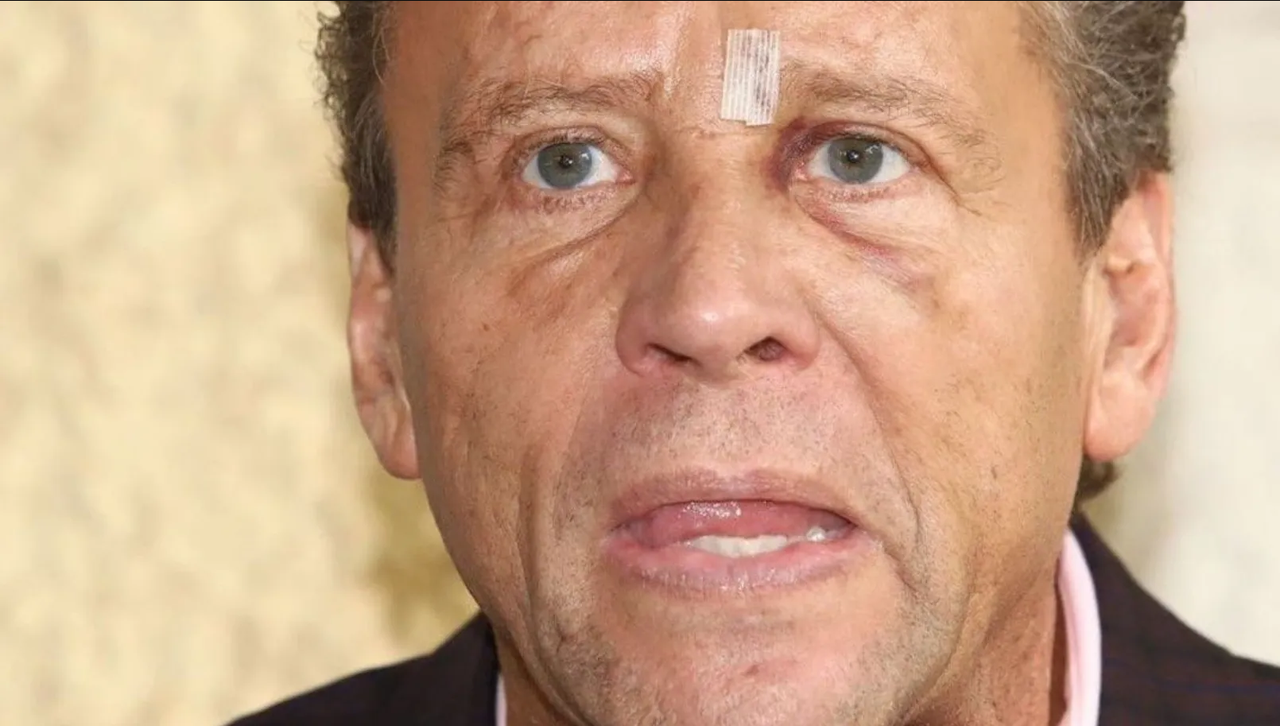 Alfredo Adame a tratamiento psicológico tras golpiza que recibió