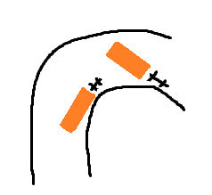 junk