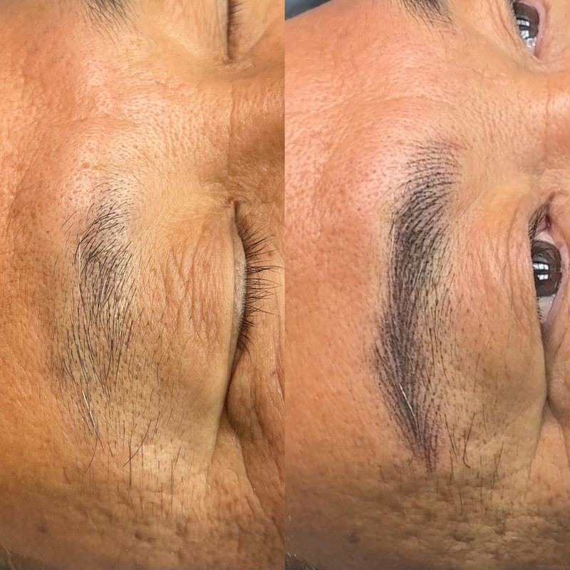 Eyebrow Enhancement Example 11