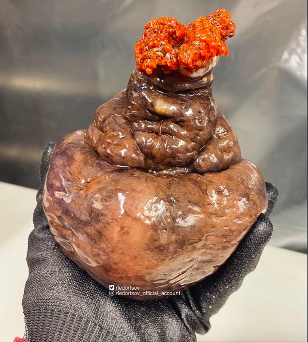 Pescador en Rusia atrapa a extraño pez parecido a la mandragora de Harry Potter