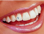 Dental Jewelry