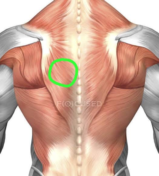 Dor no meio das costas - lesão no trapézio? - Saúde e bem estar - Fórum  Hipertrofia
