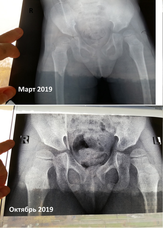 Совместный снимок_sm