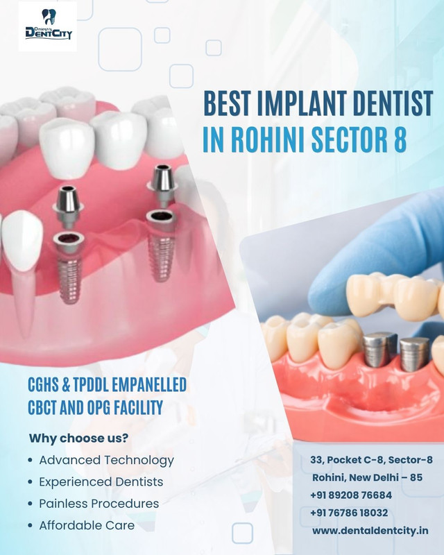 Best Implant Dentist in Rohini Sector 8