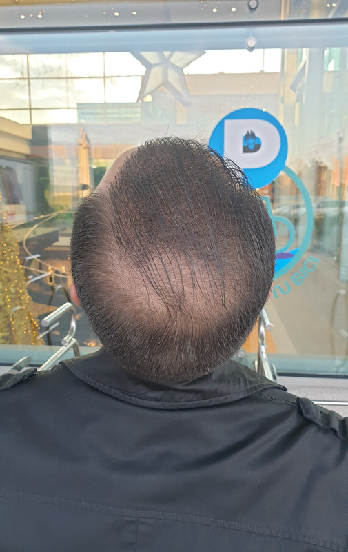 Point Blur_Dec082019_164420