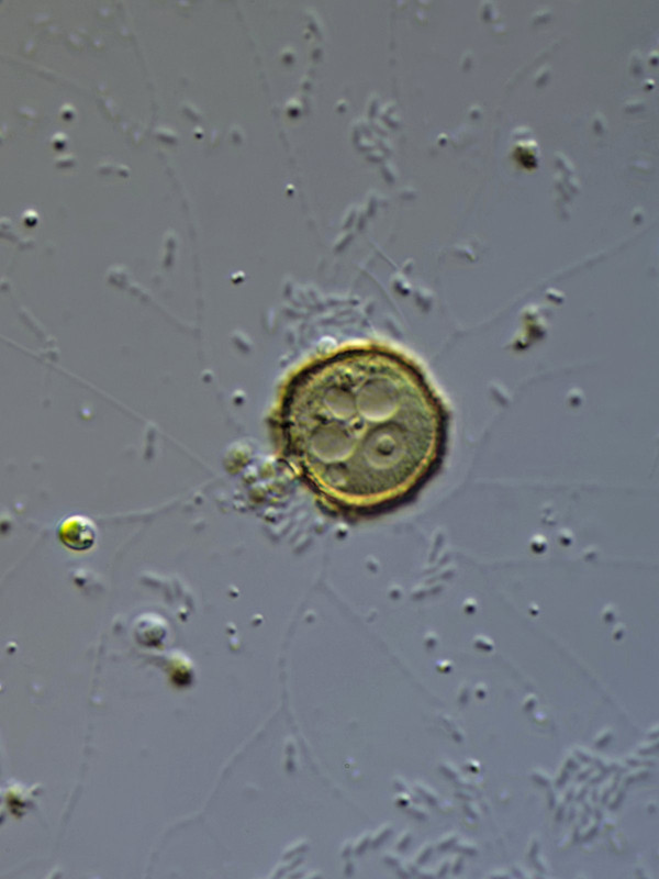 Heterogromia (ev) sp Filose Amöbe (mehrere Kontraktile Vakuolen) DIK 100 -Z7