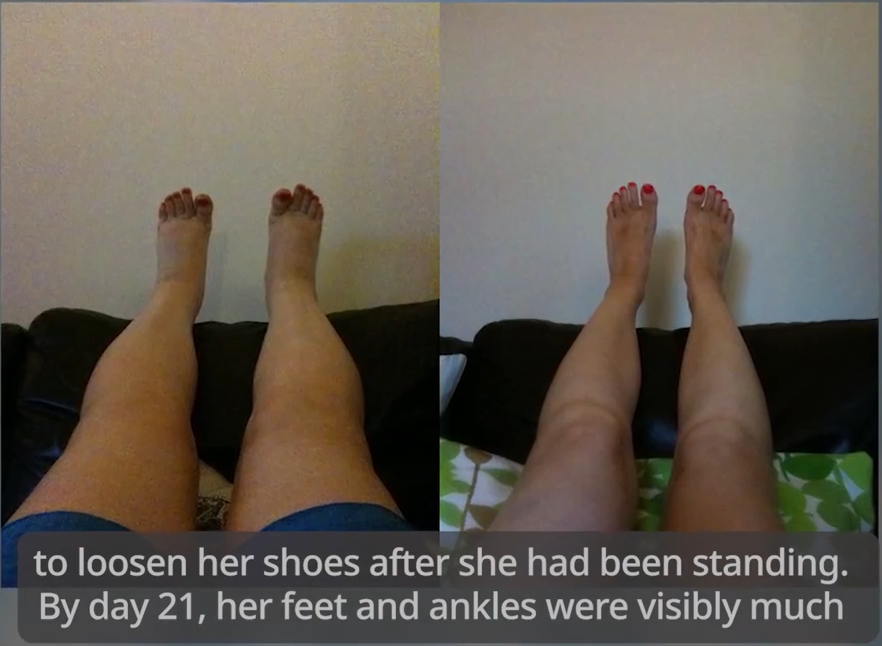 preview image swollen feet relief video
