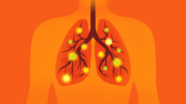 mycoplasma-pneumoniae-782x440-1.jpg