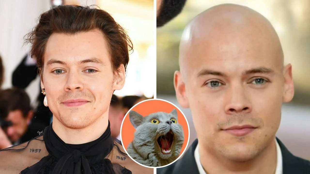 Harry Styles deja en shock a fans tras confesar que ha quedado calvo