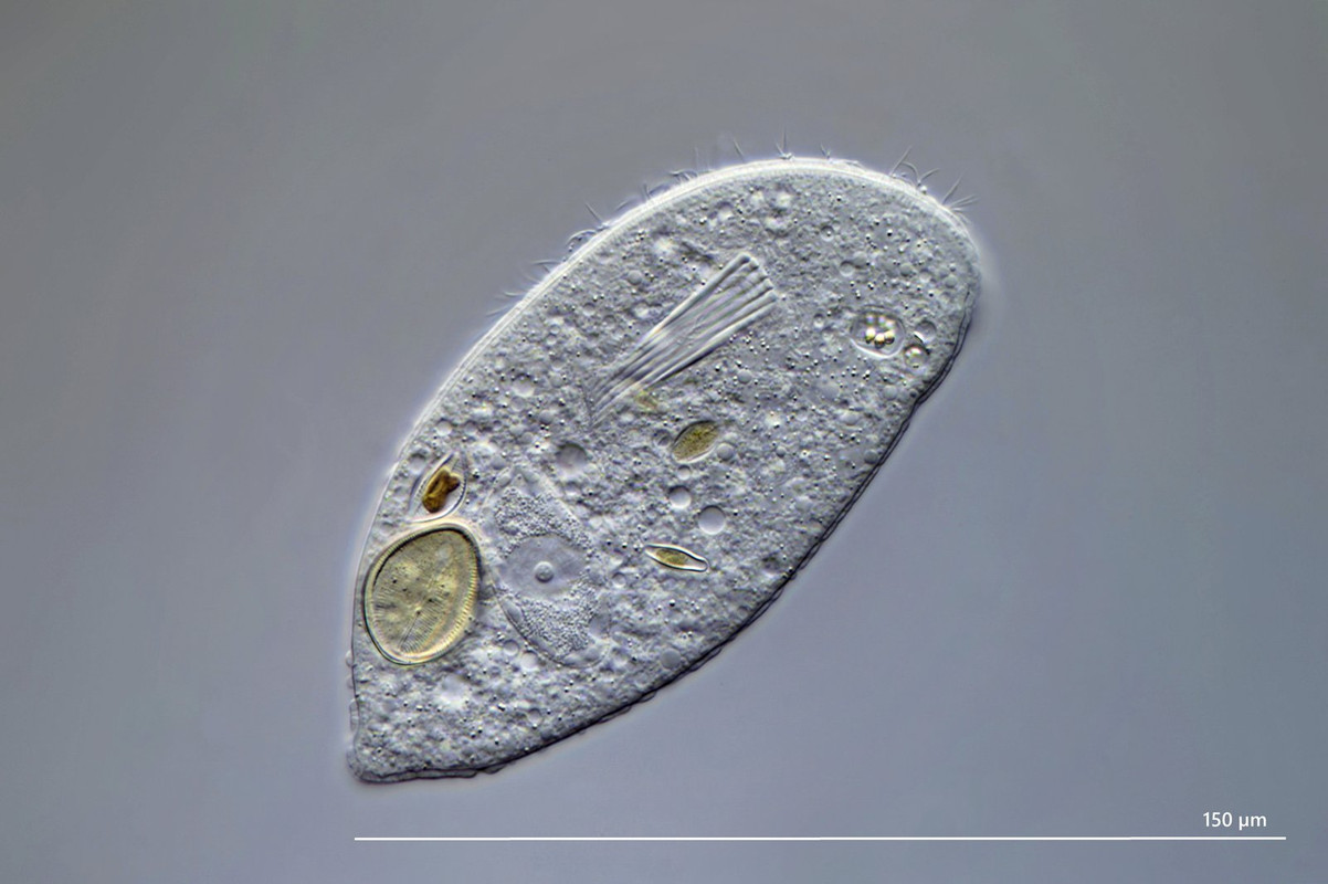 Trithigmostoma 10 (ev) cucullulus mit Cocconeis Diatomee DIK 100