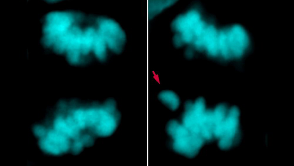 Scoperta la differenza chiave tra il Cervello umano e quello dei nostri antenati più vicini