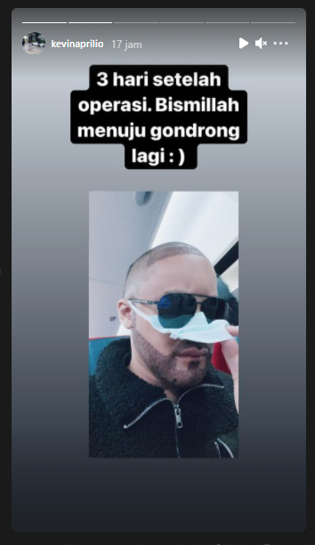 Kondisi Kevin Aprilio tiga hari setelah melakukan transplantasi