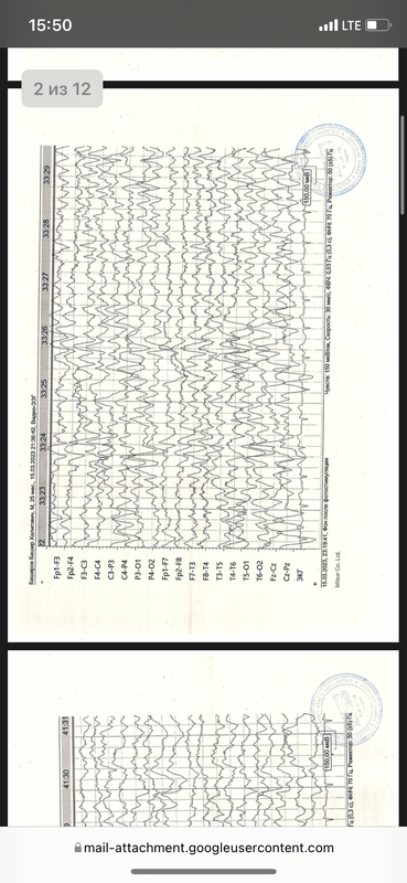 29ED25C0-DB2E-4ECF-8DF4-B3E37D95045F