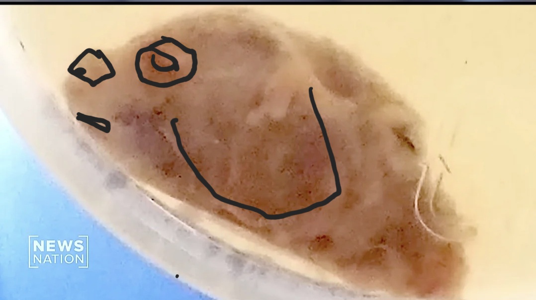 Screenshot_20240916_000522_Reddit