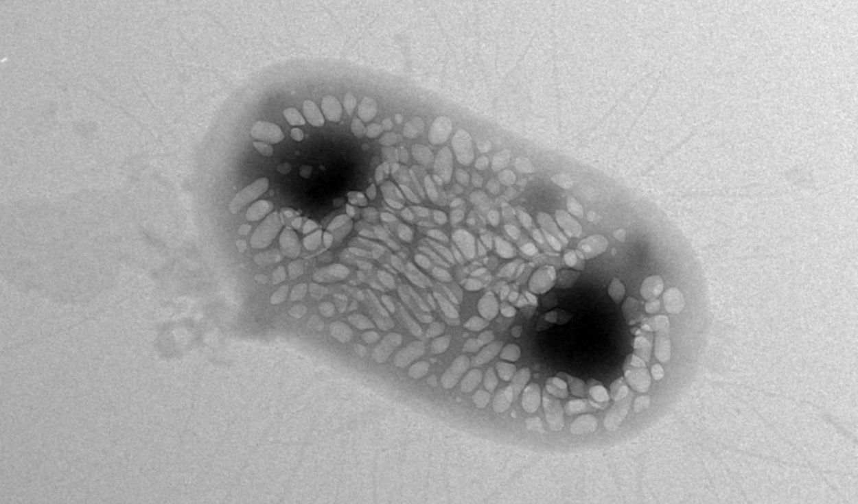 scoperta supermolecola fabimicina batteri resistenti antibiotici
