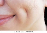 dimples when smiling on both cheeks