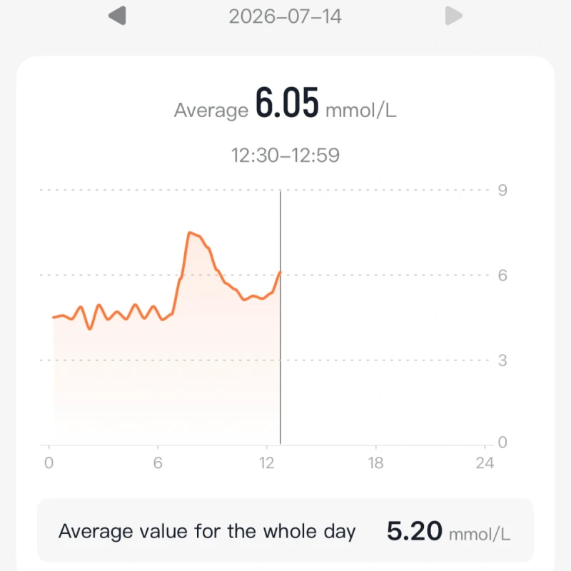 Stress Monitoring
