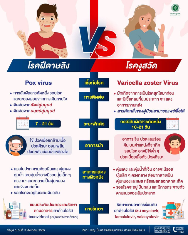 "โรคฝีดาษลิง" กับ "โรคงูสวัด" ต่างกันยังไง