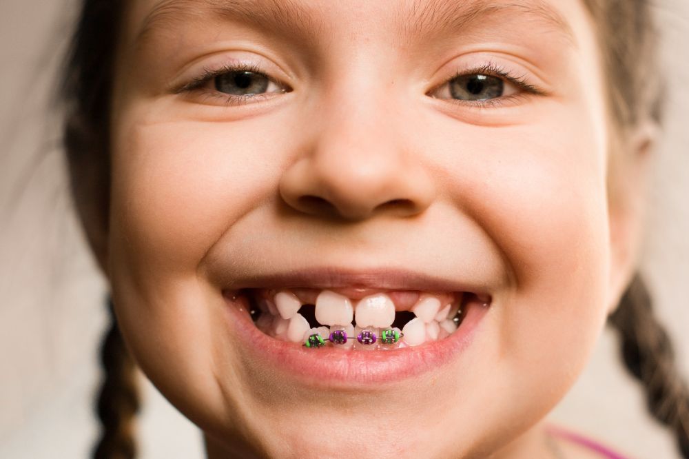 Child with Braces