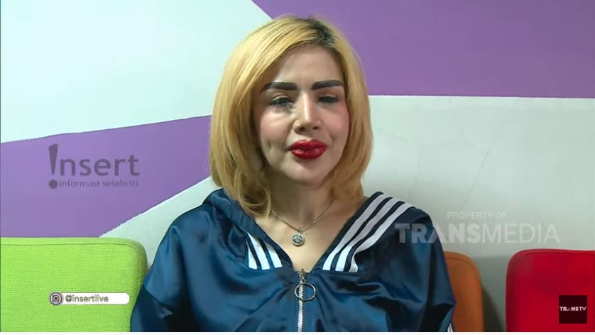 Bibir Barbie Kumlasari bengkak gegara sulam bibir