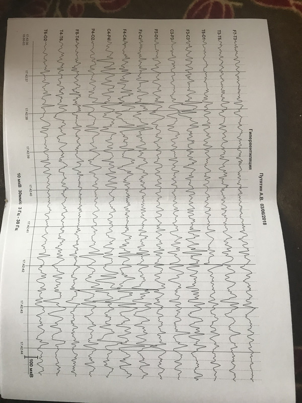 CC32B6B7-1053-40F5-B451-40818AC95C21