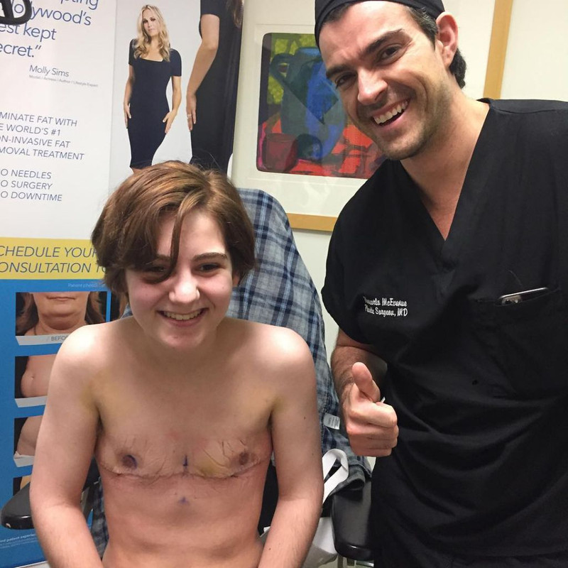 ftm breast removal 2