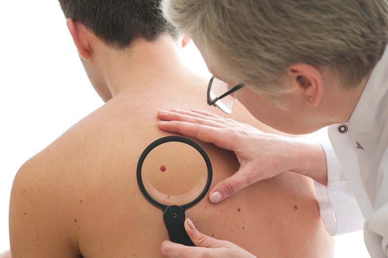 Skin Cancer Clinic