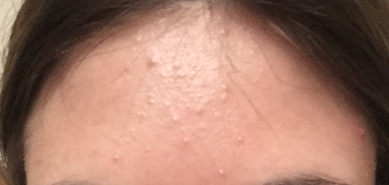 B8BE610A-FEB7-4E9D-91FE-9744FDD0D5E3