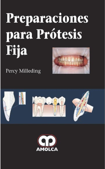 Preparaciones para prótesis fija - Percy Milleding (PDF) [VS]