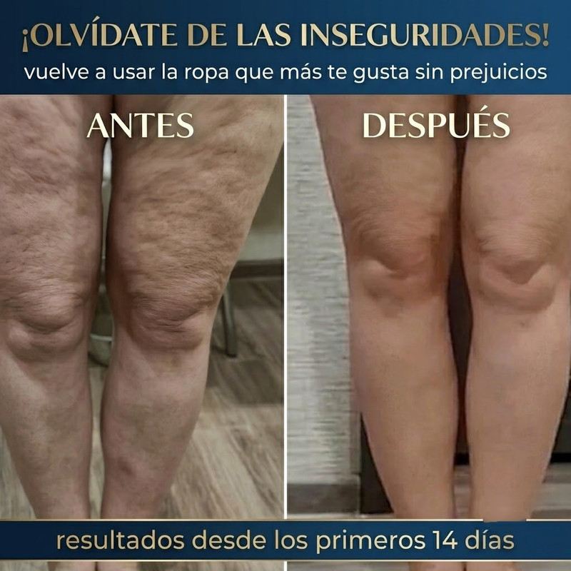 Imagen personalizada