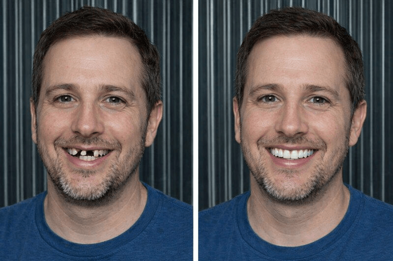 [Caso clínico de paciente antes y después Alex]