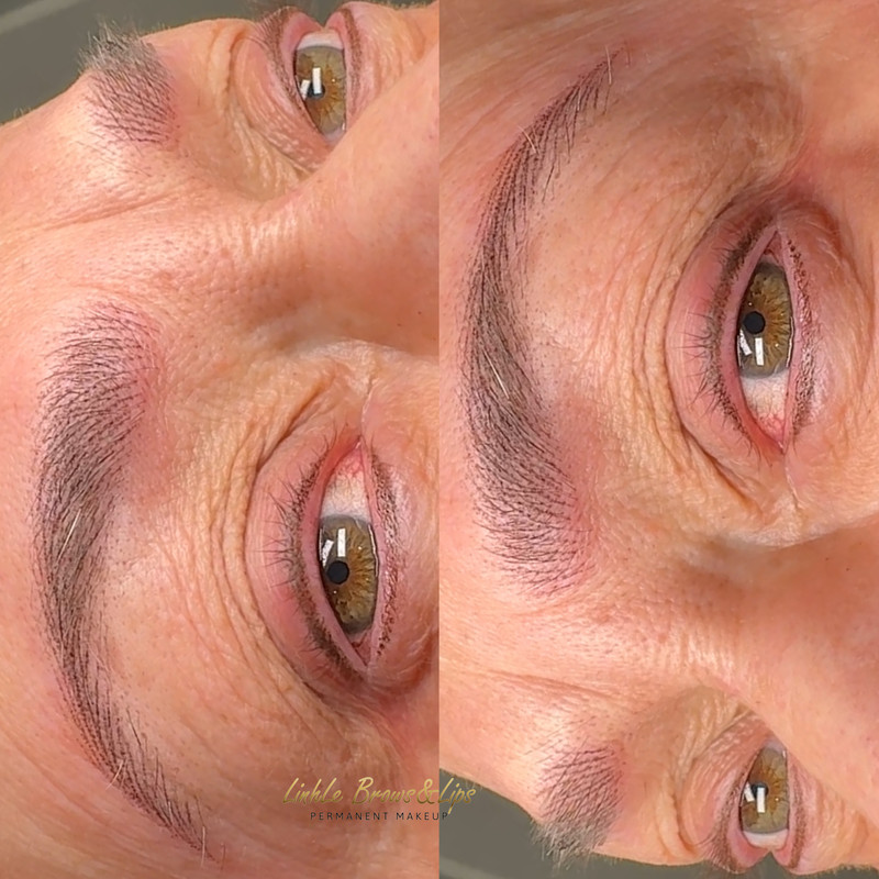 Eyebrow Enhancement Example 10