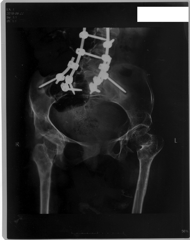 сканирование0505