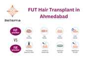 FUT Hair Transplant in Ahmedabad