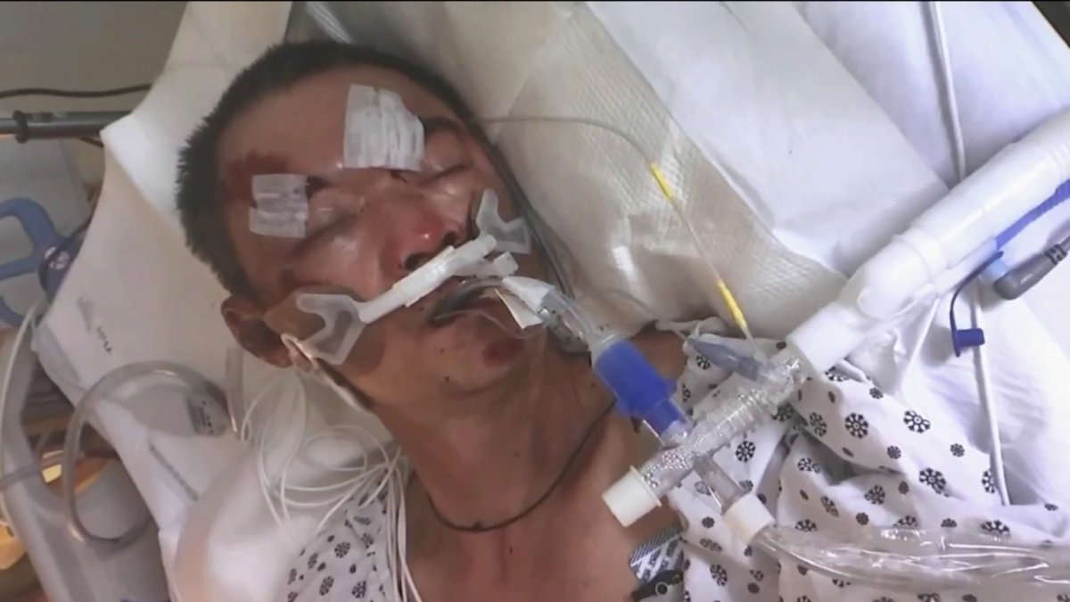 En Nueva York muere inmigrante chino meses después de ser atacado
