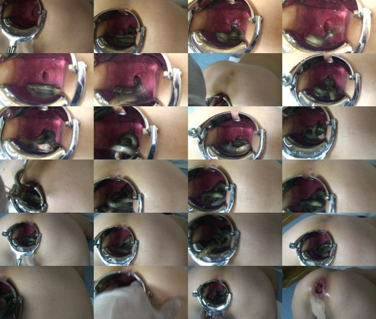 845845845845Fis