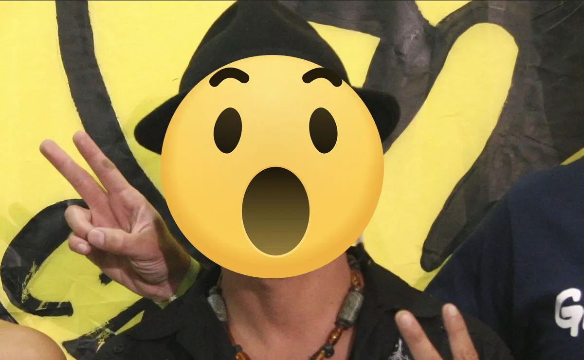 Tras perder la piel de su rostro, famoso cantante vuelve a los escenarios