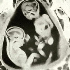 e08b6232-87a6-423e-b50a-a45be4ce9494.gif