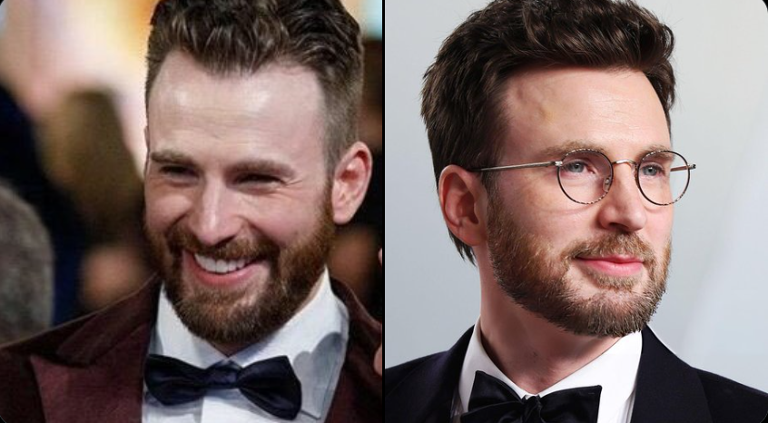 Chris Evans Plastic Surgery Rumors Swirl After Fans Notice Key Detail In Oscars Snap
