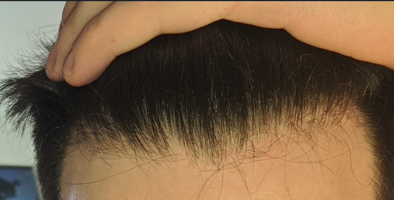 8. maggio 2020. Avevo appena tagliati i capelli dopo averli fatti crescere per 5 mesi. Mi vedevo sor