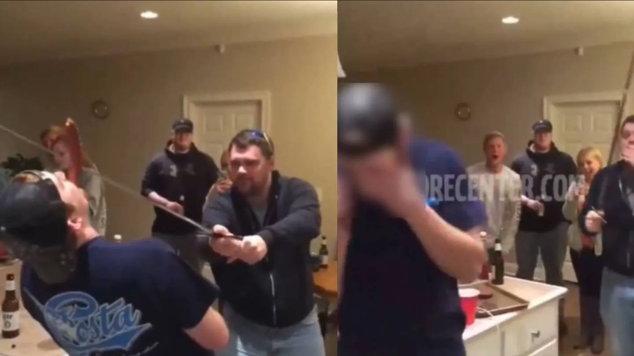 ¡TERRIBLE! Joven le corta la nariz a su amigo por reto viral