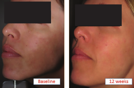 Clinical Before and After Results