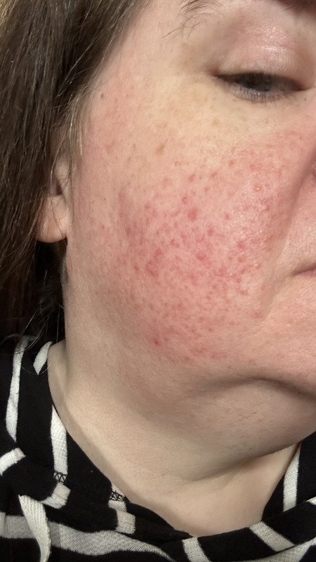 E2C00D7C-417E-4E87-99E7-DBA5A66FBA0A