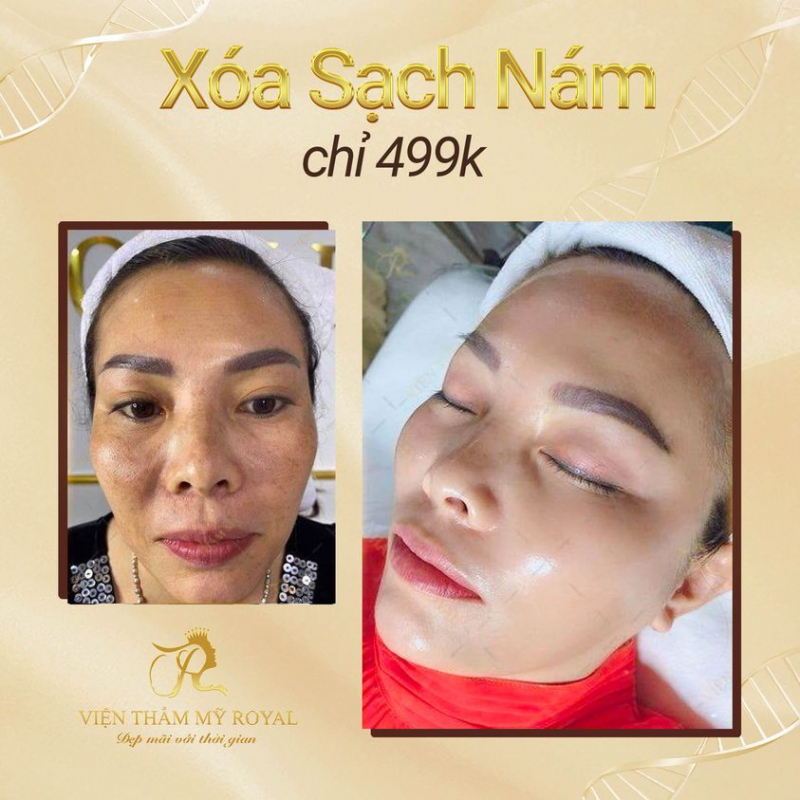 Top 10+ Spa Bắc Ninh Uy tín giúp chị em Đẹp Tức Thời, viện thẩm mỹ royal bắc ninh
