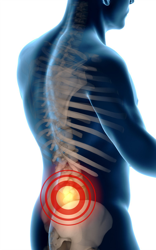 Anatomy of the sciatic nerve, a common source of sciatic nerve pain