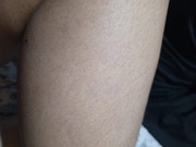 left calf