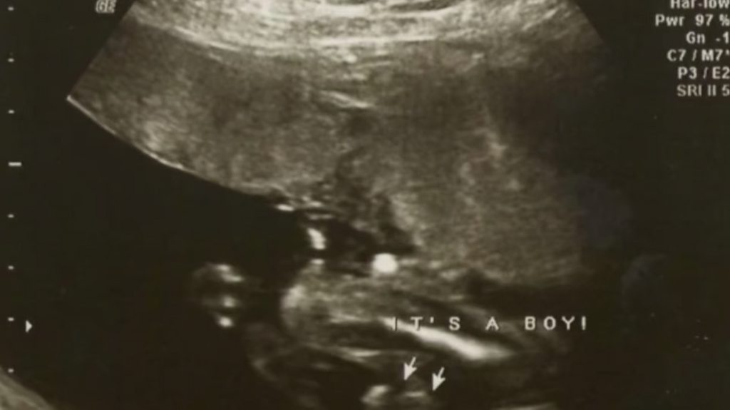 [Image: n92yqhtk7ra3.png]