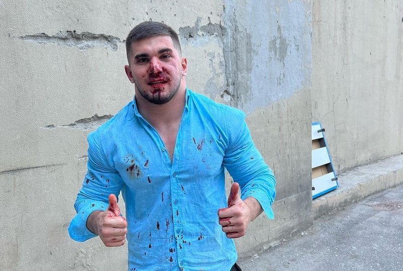 Чеченски блогър беше пребит в Дагестан за неправилно паркиране
