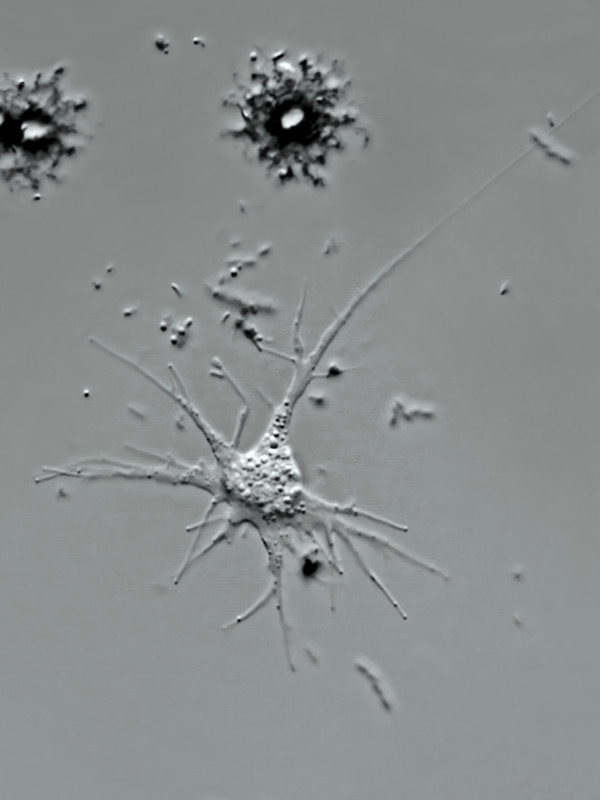 Dracoamoeba 02 (ev) sp Drachen-Amöbe Ramose (verästelte) Pseudopodien DIK 100