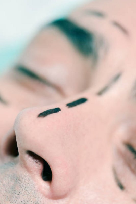 nose-jobs-4.jpg